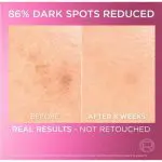 L’Oréal Paris Glycolic Bright Skin Brightening Serum-30ml