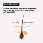 L'Oréal Professionnel Scalp Advanced Anti-Dandruff Dermo-Clarifier Shampoo -300 Ml