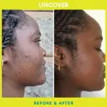Uncover Green Tea Blemish Control Serum 30ML Uncover Green Tea Blemish Control Serum 30ML