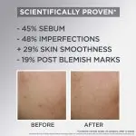 GARNIER PURE ACTIVE AHA+BHA CHARCOAL MATTIFYING AIR CREAM