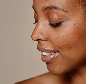 Dark Spots