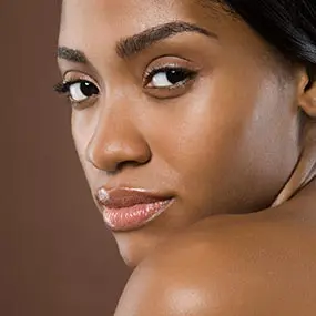 Uneven Skin Tone